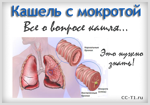 Сухой кашель лечение в домашних условиях народными средствами Сухой кашель лечение в домашних условиях народными средствами