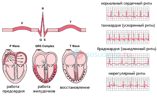 Что значит синусовая аритмия у ребенка как лечить Что значит синусовая аритмия у ребенка как лечить